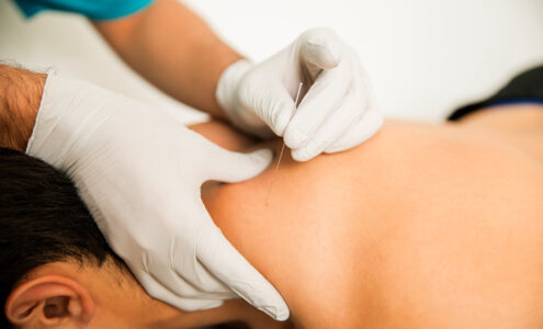 puncte de acupunctura pe corp
