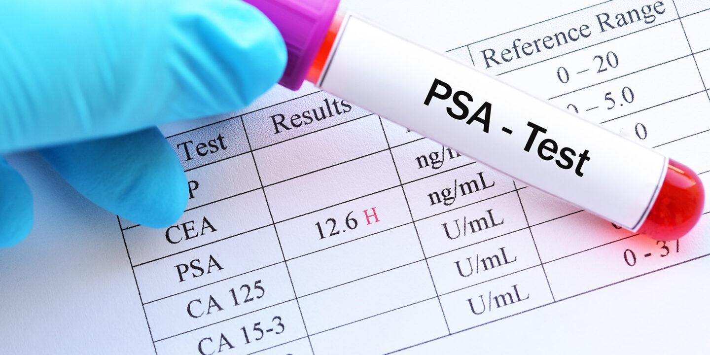 PSA-test