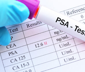 PSA-test