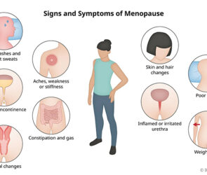 Semne menopauza