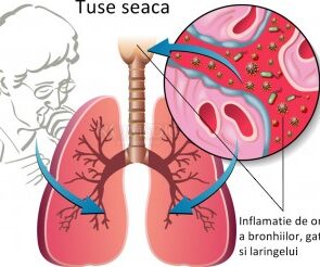 Tusea seaca