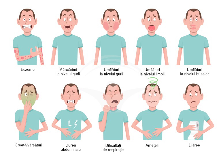 Alergia alimentara